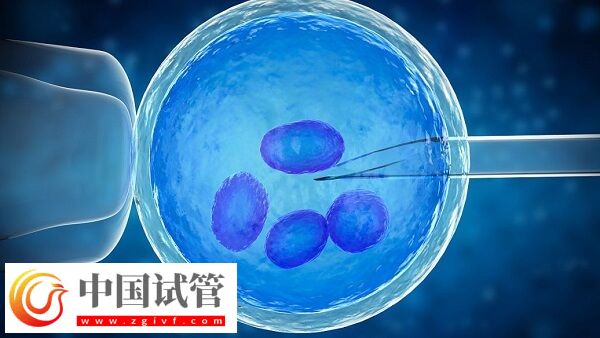 人工周期要去几次医院(图2)