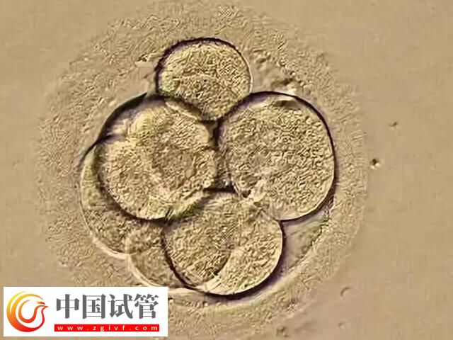 如何改善一卵多精的情况(图1)