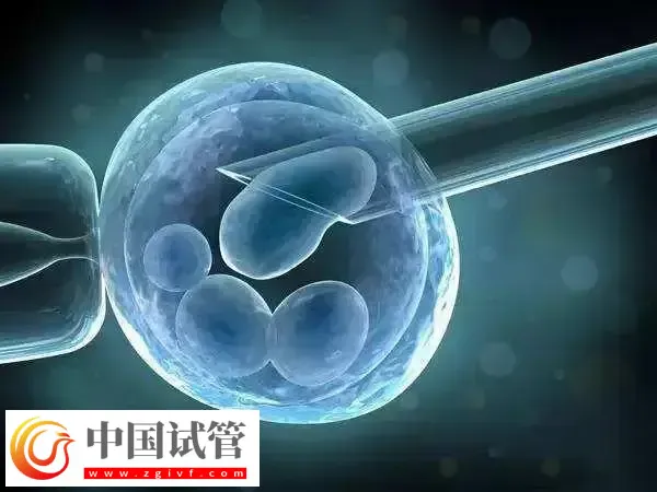 试管促排哪个方案最便宜(图3)