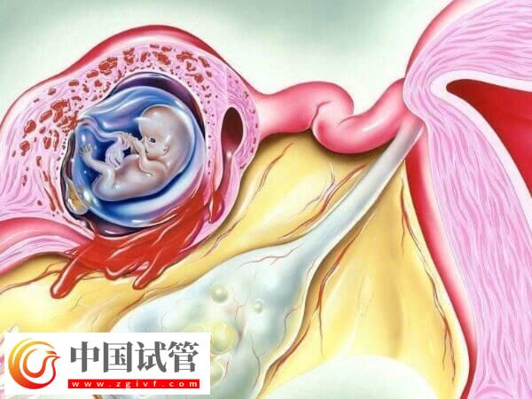 试管移植第三天出血是不是着床了(图1)