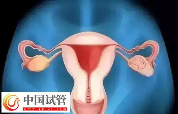 腹腔镜子宫切除手术怎么做(图1)