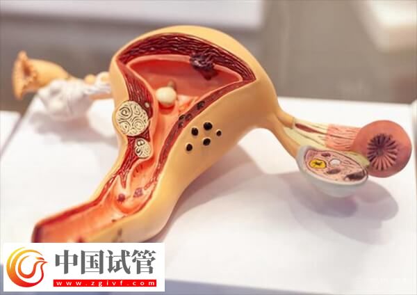 子宫肌瘤女性不能吃的食物有哪些(图1) 子宫肌瘤女性不能吃的食物有哪些(图1)