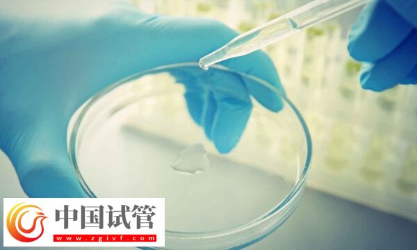 试管婴儿精液检查都有什么项目(图1) 试管婴儿精液检查都有什么项目(图1)