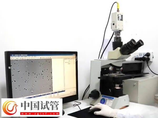 试管婴儿精液检查都有什么项目(图2) 试管婴儿精液检查都有什么项目(图2)