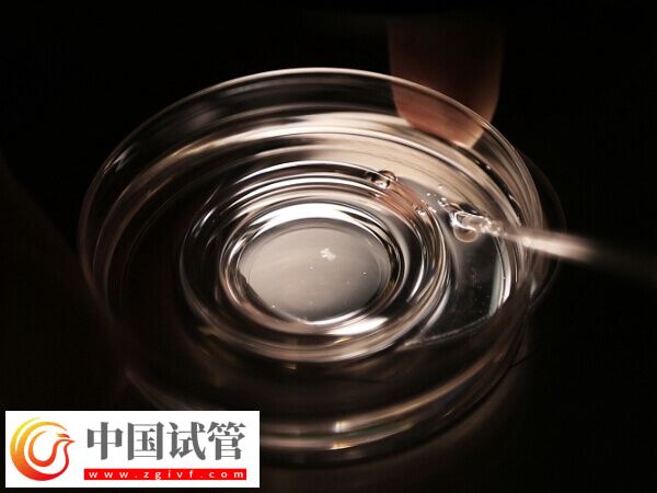 第四代试管婴儿适不适合大龄女性(图1)