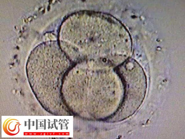 试管婴儿移植失败是怎么回事(图1)
