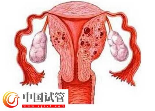 始基子宫融合后可不可以生孩子(图1)