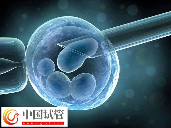 三代试管婴儿一个周期多长时间(图2) 三代试管婴儿一个周期多长时间(图2)