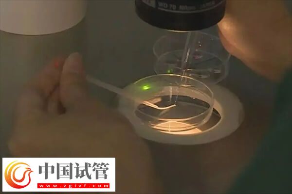 做试管婴儿是不是很受罪(图1)