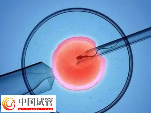 取卵同时能不能穿刺囊肿(图1) 取卵同时能不能穿刺囊肿(图1)