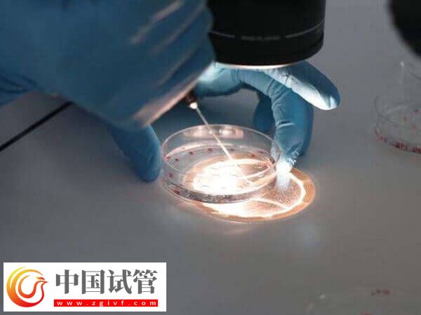 为什么试管养囊第6天才成功(图1)