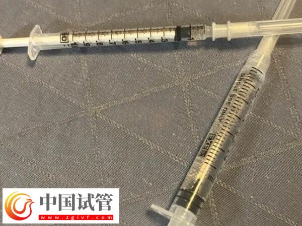 试管长方案珍怡的作用有哪些(图2)