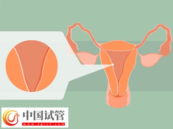 子宫内膜4mm是怎么回事(图1) 子宫内膜4mm是怎么回事(图1)
