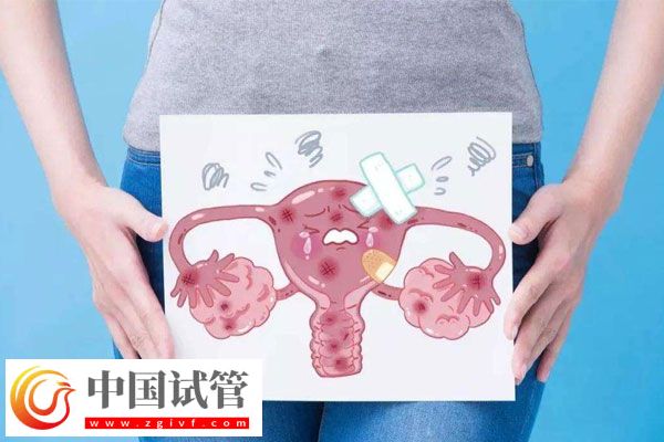 卵巢囊肿对试管助孕有影响吗？听听专家怎么说(图1)