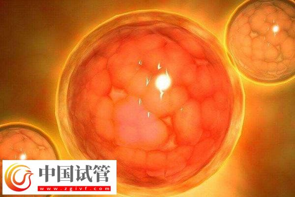 多囊卵巢综合症临床表现有那些？(图1)