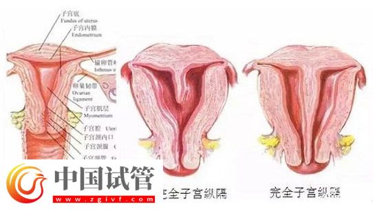 带你了解什么是纵膈子宫，别再和双子宫搞混了(图1)