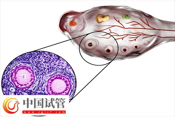 试管婴儿促排期间注意事项有哪些呢?(图1) 试管婴儿促排期间注意事项有哪些呢?(图1)